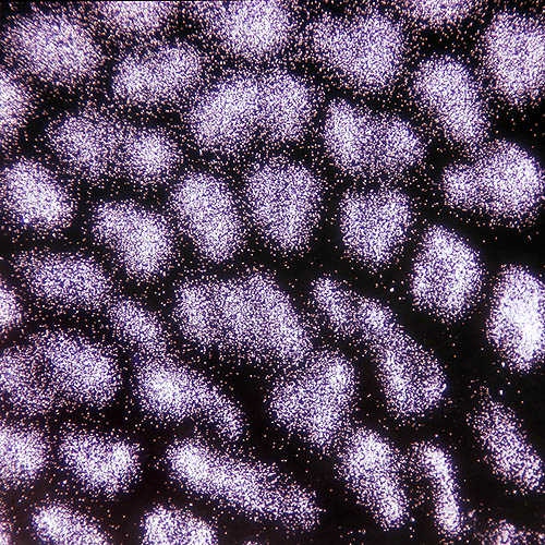 Spores de Boletus aestivalis vues au microscope à faible agrandissement © G. Mazza