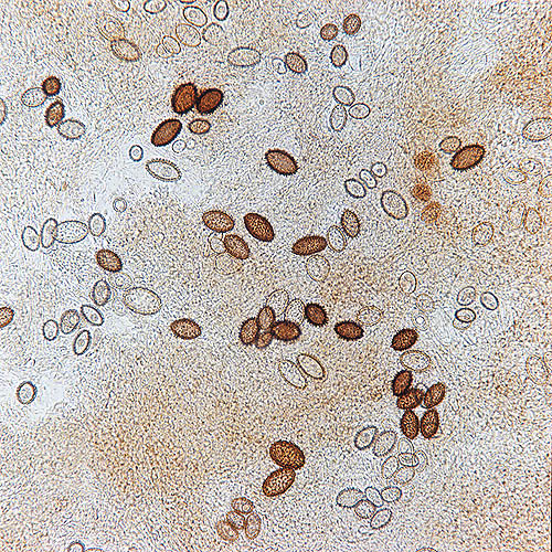 Esporas de Tuber melanosporum observadas en el microscopio © Giuseppe Mazza