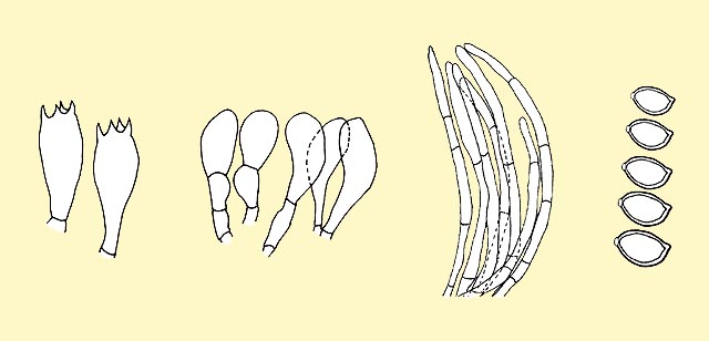 Basidi, cheilocistidi, pileipellis e spore di Macrolepiota procera © Pierluigi Angeli