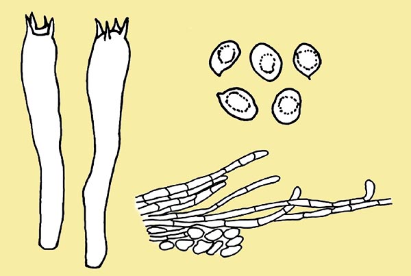 Tricholoma terreum, basidia, spores and pileipellis
