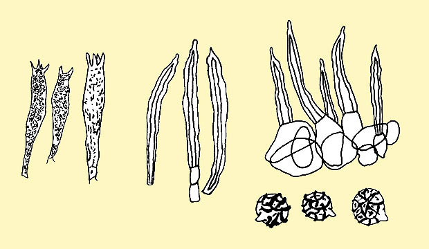 Lactarius volemus : basides, cystides, cuticule et spores © Pierluigi Angeli