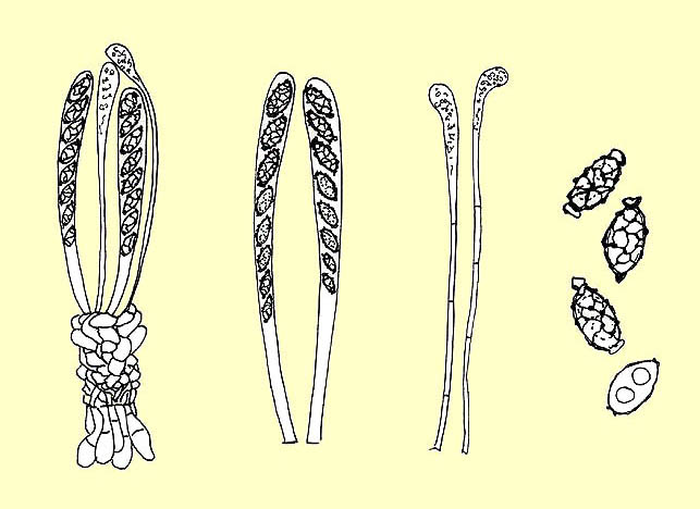 Aleuria aurantia: excipulum section, asci, paraphysis and spores © Maria Tullii