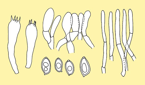 Macrolepiota mastoidea spores, basidia, cheilocystidia and pileipellis © Pierluigi Angeli