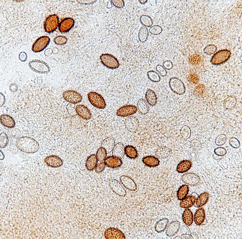 Tuber melanosporum spores seen with microscope © Giuseppe Mazza