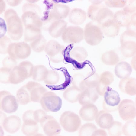 Trypanosoma gambiense entre las células rojas de la sangre © Giuseppe Mazza