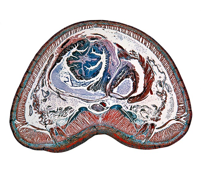 Lumbricus terrestris section seen under microscope. From periphery, we see the skin, followed by a layer of circu- <br />lar muscles (turquoise line),then one of longitudinal muscles (purple red bands). At the section centre, we see a <br />complex round structure: a lobe attached to a turquoise peduncle. The pink longitudinal, folded, central line is the <br />Typholosolis, a loop of the belly which greatly increases its absorption. At the loop beginning in the back part of the <br />round structure, we see a dorsal blood vessel. The grey ventral structure is the nervous chain © Giuseppe Mazza